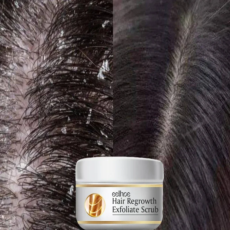 Fast Anti Dandruff Hair Treatm - Hair Care Dandruff 评论和价格