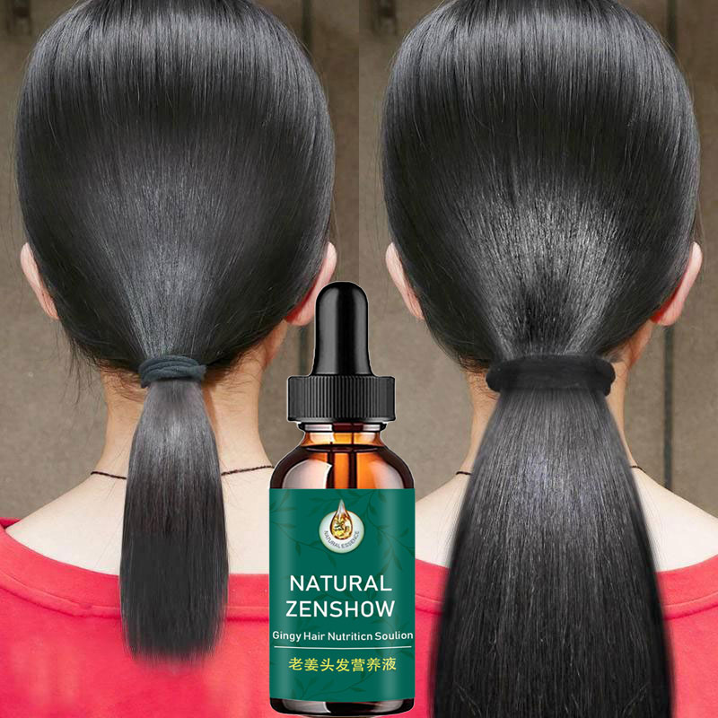 Ginger Hair Growth Essential O - Hair Care Herbal Products 评论和价格