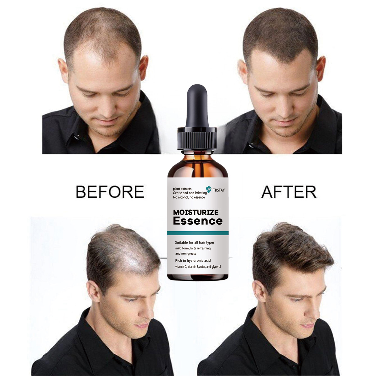 2022 New Hair Growth Essence P - Hair Care Ordinary 评论和价格