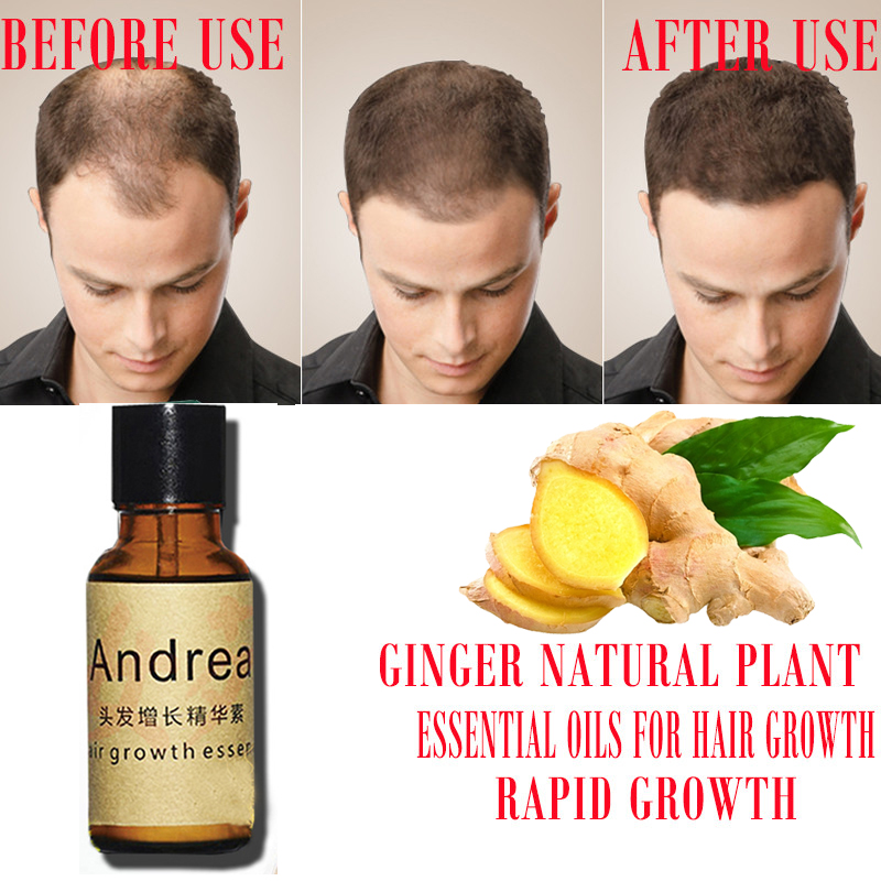 2/5/10Pcs Andrea Hair Growth S - Hair Care Herbal Products 评论和价格